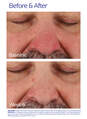 Rozatrol® (Travel Size)  hi-res image number 8